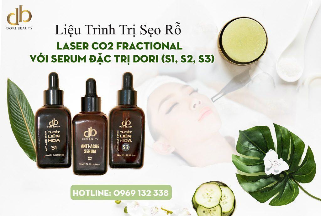 Liệu Trình Trị Sẹo Rỗ Laser CO2 Fractional và Tuyết Liên Hoa