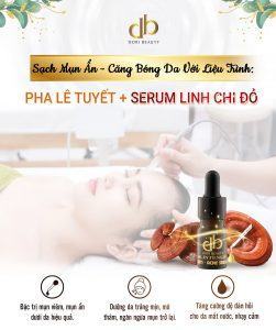 Liệu trình pha lê tuyết, serum linh chi đỏ trị mụn ẩn dưới da