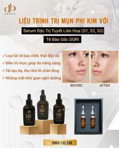 Liệu trình trị mụn phi kim tế bào gốc đặc trị chuẩn spa