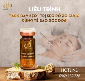 Liệu Trình Tách Đáy Sẹp - Trị Sẹo Rỗ Xơ Cứng