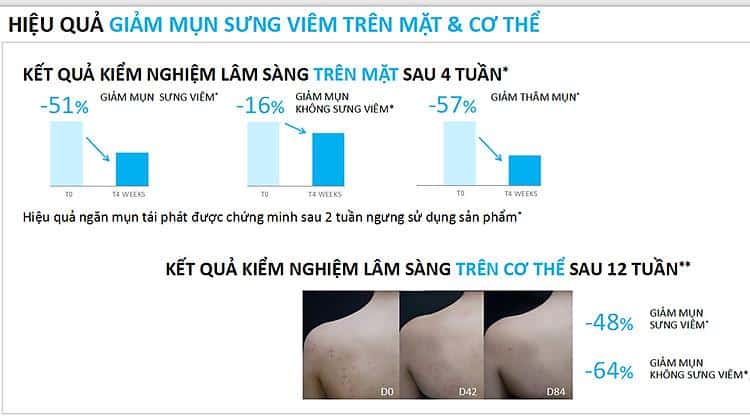Đánh giá về Gel Rửa Mặt La Roche-Posay Hỗ Trợ Giảm Mụn Cho Mặt & Toàn Thân trên Shopee