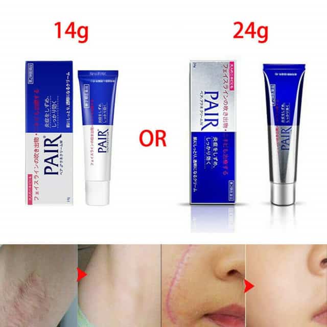 Giá kem trị mụn Pair Acne W Cream