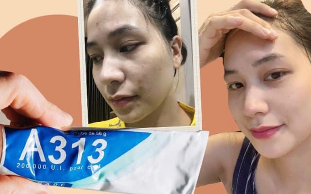 Đối tượng sử dụng kem dưỡng Retinol A313