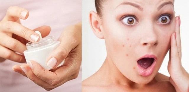 Công dụng kem dưỡng ẩm