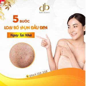 Cách trị mụn đầu đen tại nhà