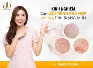 Kinh nghiệm chọn phương pháp trị mụn phù hợp