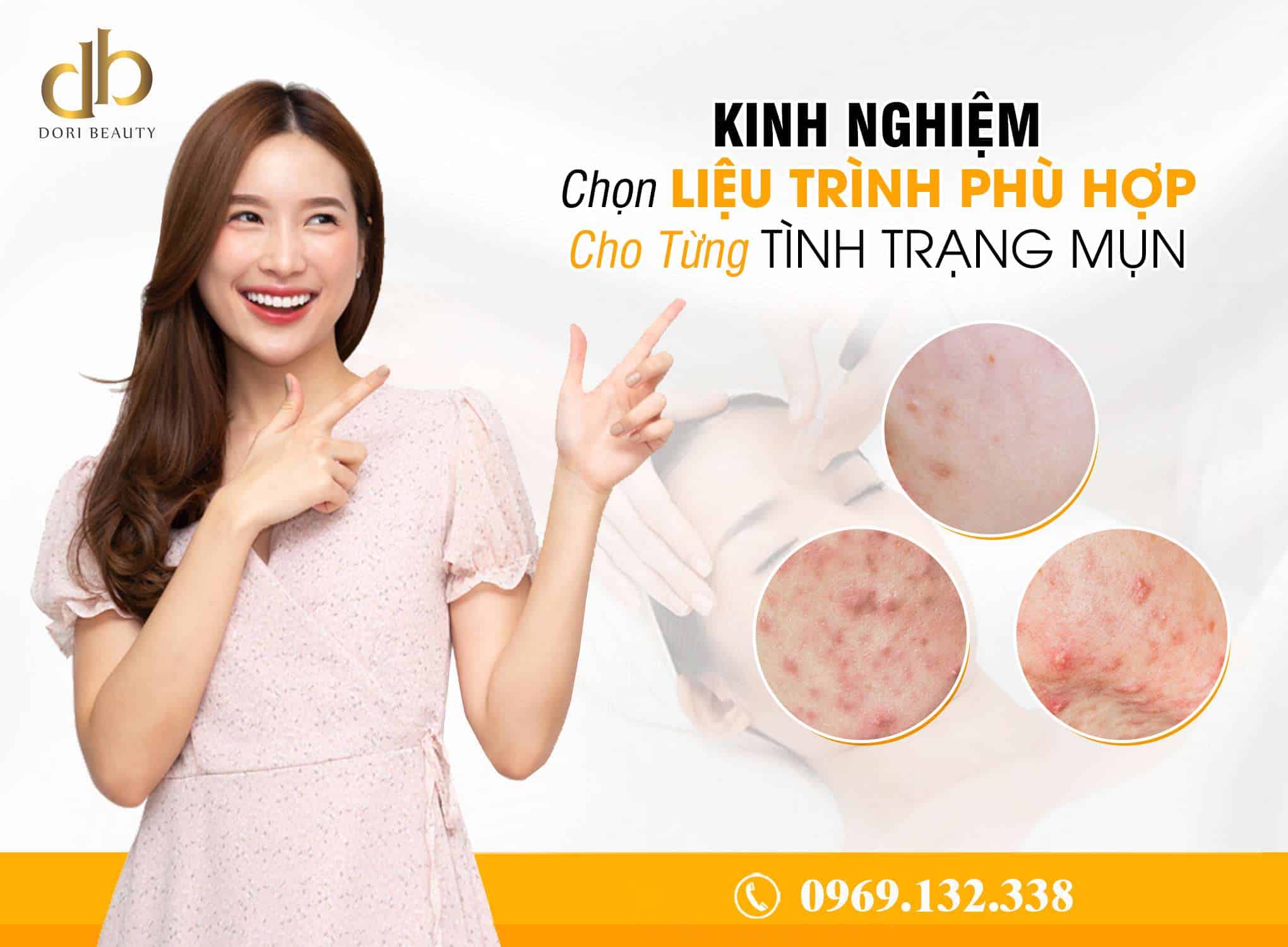 Kinh nghiệm chọn phương pháp trị mụn phù hợp