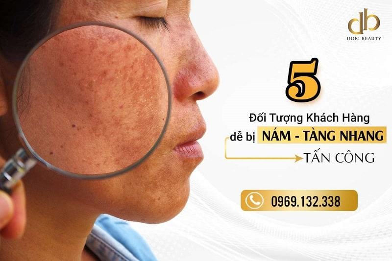 Đối tượng dễ bị nám tàn nhanh tấn công