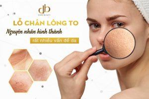 lỗ chân lông to