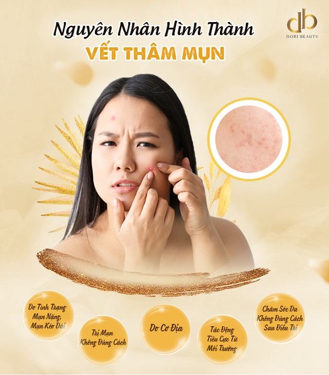 Nguyên nhân hình thành thâm mụn