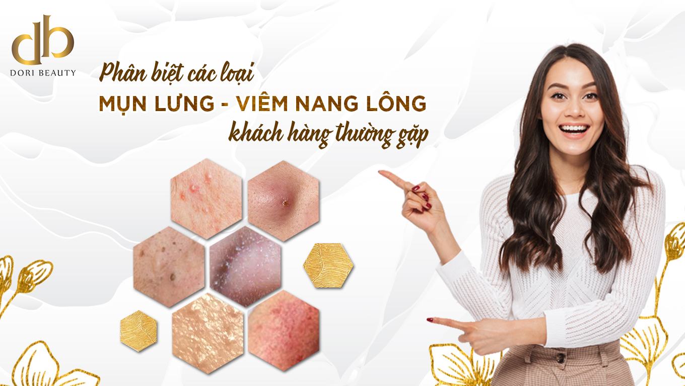 Các loại mụn lưng, viêm nang lông thường gặp và cách điều trị