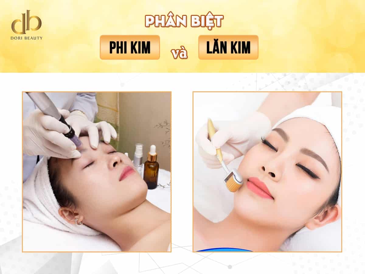 Phân biệt lăn kim và phi kim