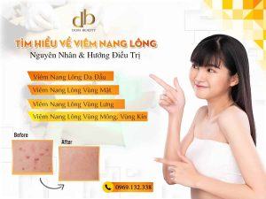 Viên nang lông là gì? Nguyên nhân và cách điều trị