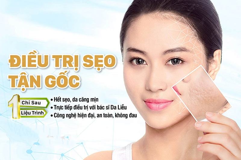 Dịch vụ điều trị sẹo rỗ mụn tại Long An uy tín