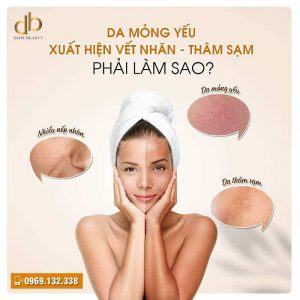 Da mỏng yếu – xuất hiện vết nhăn – thâm sạm, phải làm sao?