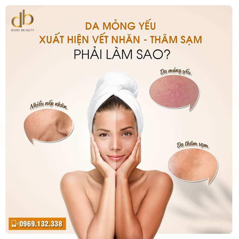Da mỏng yếu – xuất hiện vết nhăn – thâm sạm, phải làm sao?