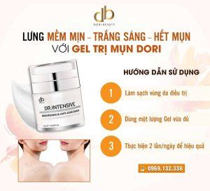 Đánh bay mụn lưng với gel trị mụn Dori