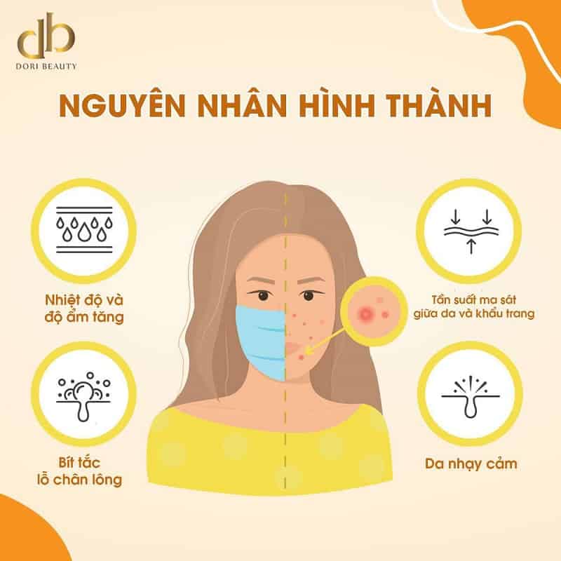 nguyên nhân gây nên tình trạng Maskne
