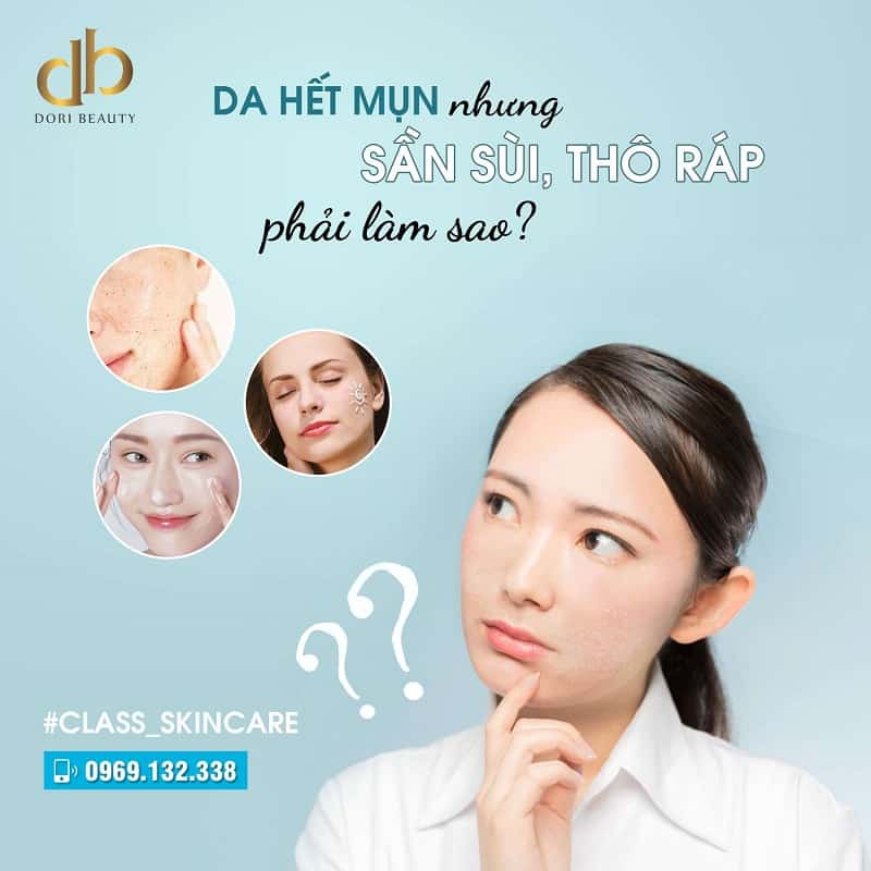 Bật Mí Cách Chăm Sóc Da Sần Sùi, Thô Ráp