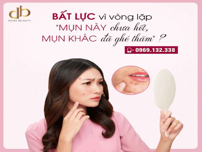 Bất lực vì mụn