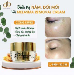 Hiệu quả điều trị nám, đồi mồi với melasma removal cream