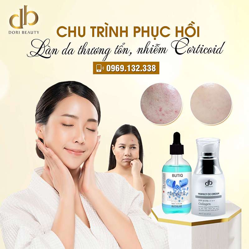 Biện Pháp Phục Hồi Da Hư Tổn, Nhiễm Corticoid 