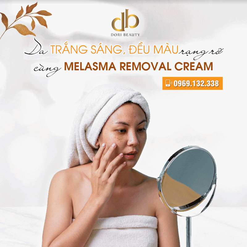 Hết Nám - Da Trắng Sáng Với Melasma Removal Cream
