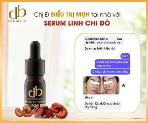 Tạm Biệt Mụn Với Serum Trị Mụn Linh Chi Đỏ