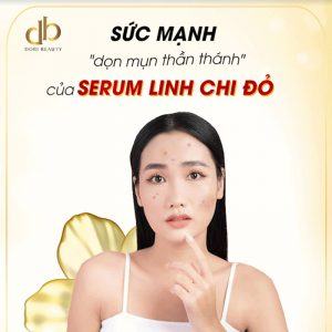 Bí Quyết "Dọn Sạch Mụn" Với Serum Linh Chi Đỏ