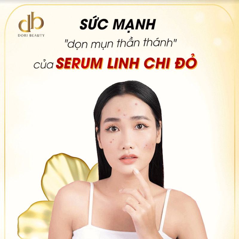 Bí Quyết "Dọn Sạch Mụn" Với Serum Linh Chi Đỏ