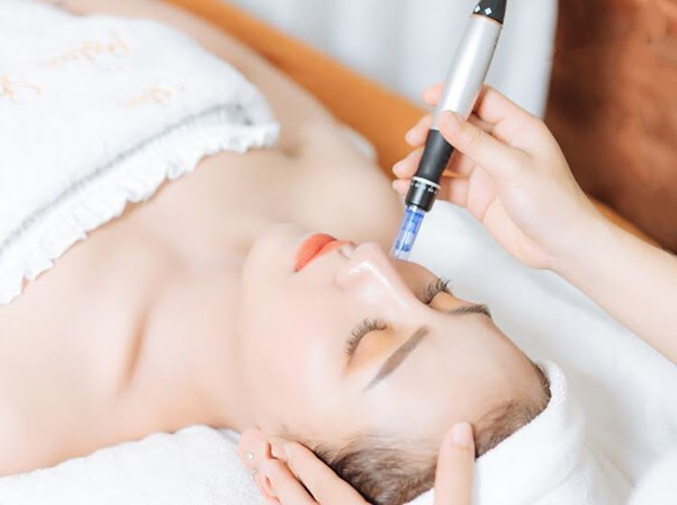 Công nghệ trị sẹo rỗ Phi Kim Tế Bào Gốc tại spa được yêu thích 
