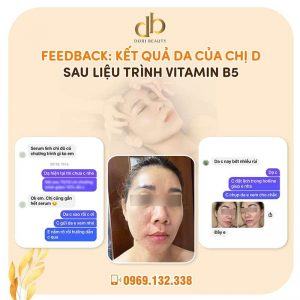 Bất Ngờ Kết Quả Da Chị D Sau Liệu Trình Vitamin B5