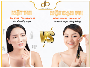 "Say Bye" Với Mụn Nhờ Serum Linh Chi Đỏ