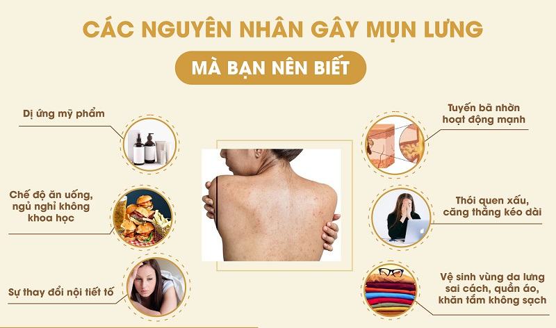 Nguyên nhân hình thành mụn lưng
