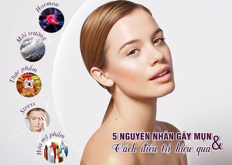 Những nguyên nhân chính gây mụn