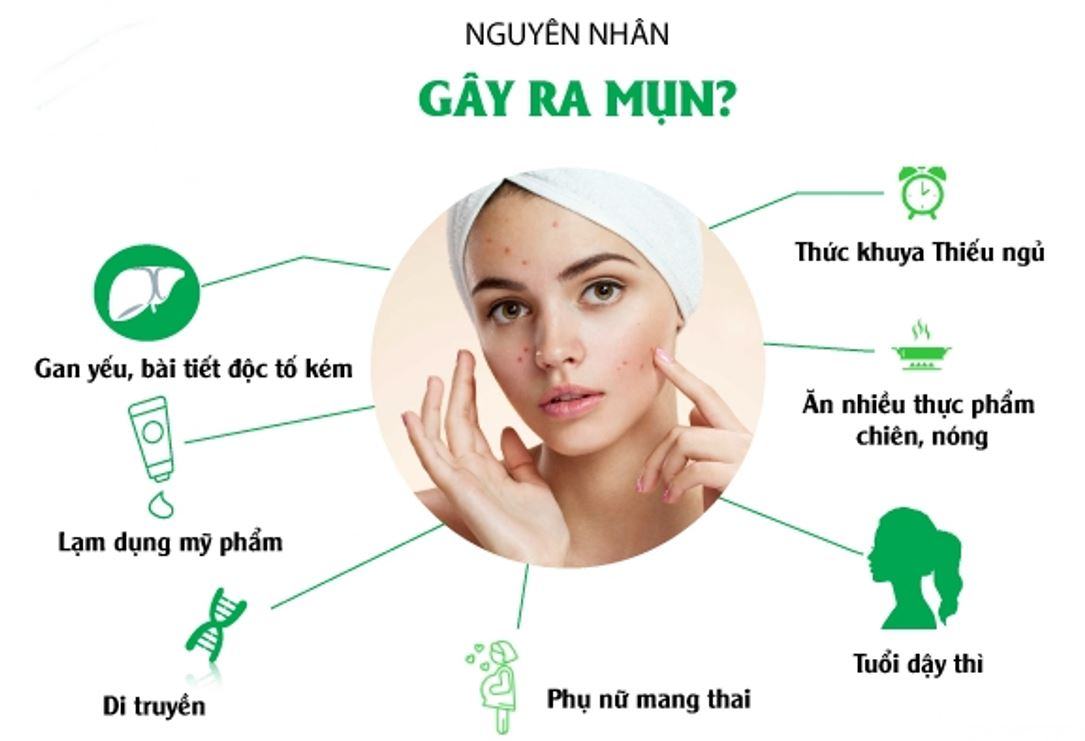 Nguyên nhân chính gây ra mụn trên mặt