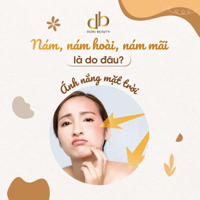 Nám do tiếp xúc ánh nắng mặt trời