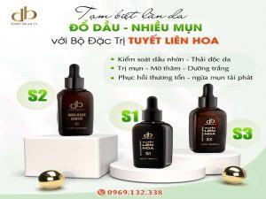 Bộ Đặc Trị Tuyết Liên Hoa: "Tạm Biệt" Dầu Nhờn - Mụn