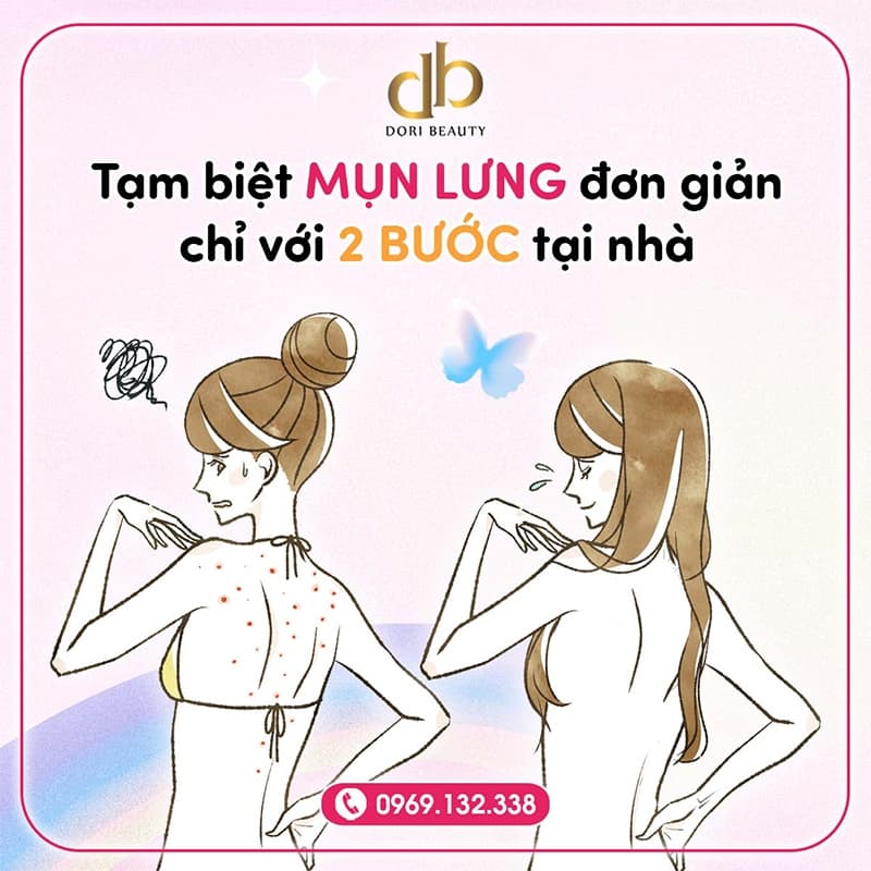Bật Mí 2 Bước Đơn Giản Trị Mụn Lưng Tại Nhà