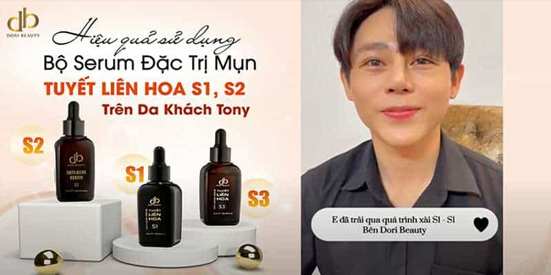 Kết Quả Dùng Bộ Serum Đặc Trị Mụn Tuyết Liên Hoa Trên Da Khách