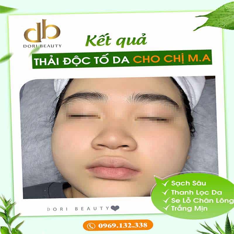 Hình Ảnh Thải Độc Tố Da Cho Chị M.A