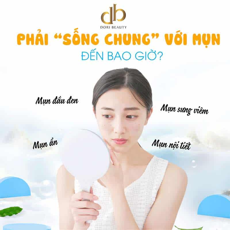 Chấm Dứt Cảnh "Sống Chung Với Mụn"