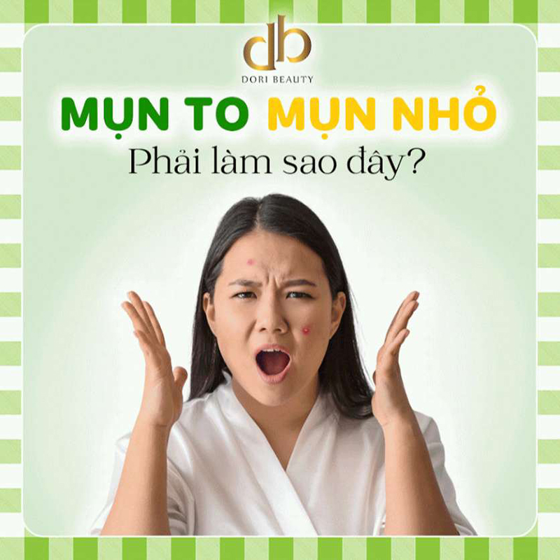 Da mặt đầy mụn phải làm sao đây?