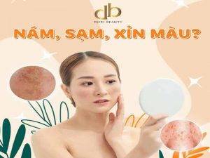 Ám Ảnh Da Xỉn Màu, Sạm, Nám Đã Có DORI Lo