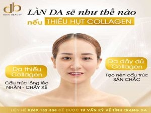 Làn Da Sẽ Như Thế Nào Nếu Thiếu Hụt Collagen?