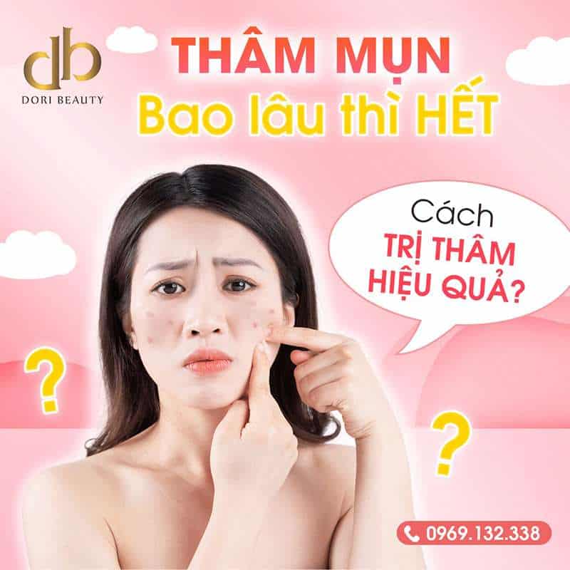 Thâm mụn bao lâu thì hết? Cách trị thâm hiệu quả