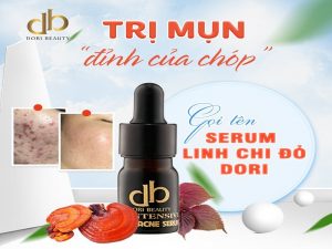 Trị Mụn “Đỉnh Của Chóp” => Gọi Tên Serum Linh Chi Đỏ Dori.