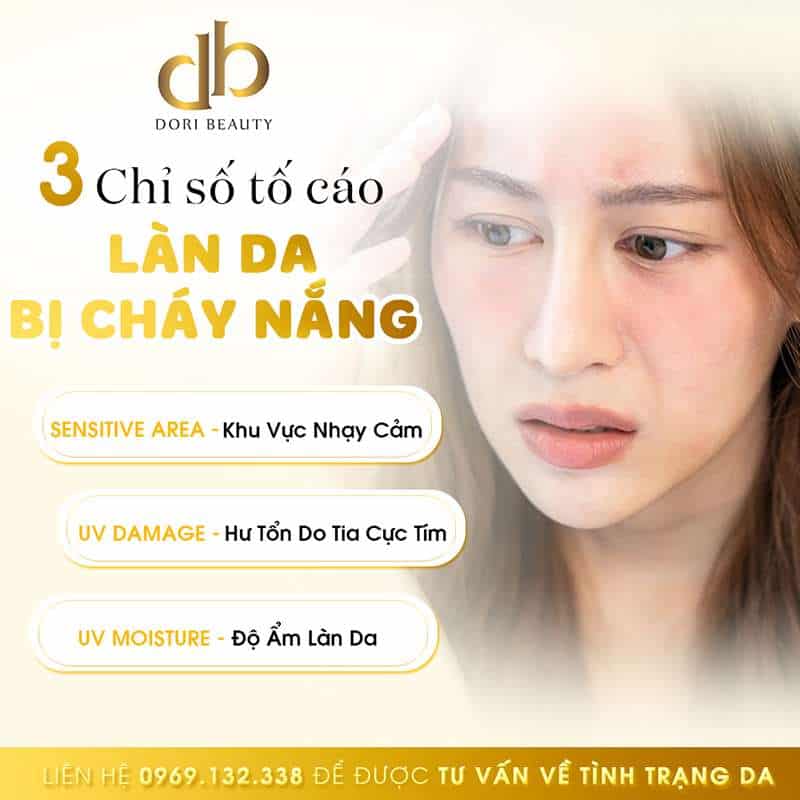 3 Chỉ Số Tố Cáo Làn Da Bạn Đang Cháy Nắng
