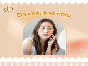 Da Khô – Sần – Ngứa Đã Có Huyết Thanh Thủy Tinh Lo