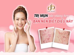 Trị Mụn Nhẹ Nhàng Hơn Nếu Bạn Biết Những Điều Này